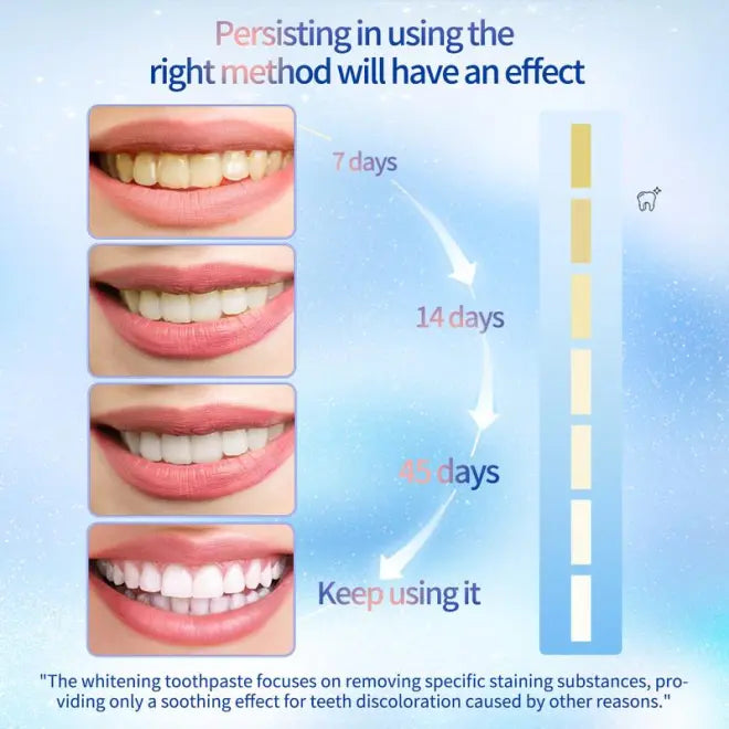 BodyAccel 【Tripel Whitening】Niacinamide Whitening Toothpaste